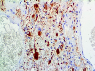 IHC of Neurofilament on an FFPE Brain Tissue